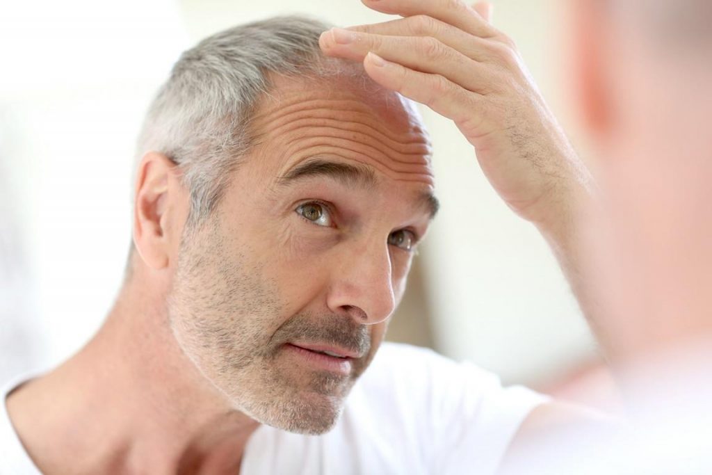 How To Become A Reliable Hair Transplant Expert?