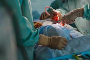 IVF process