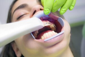 Problematic For Teeth