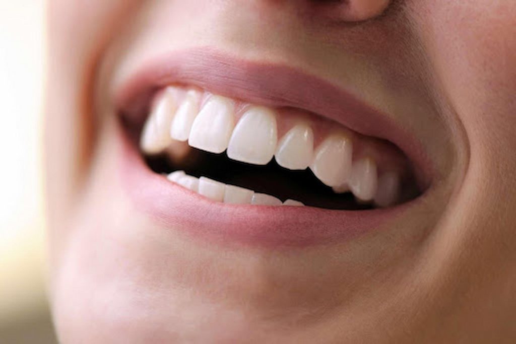 The Essential Tips Before Undergoing Teeth Whitening Treatment