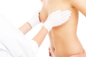 breast augmentation