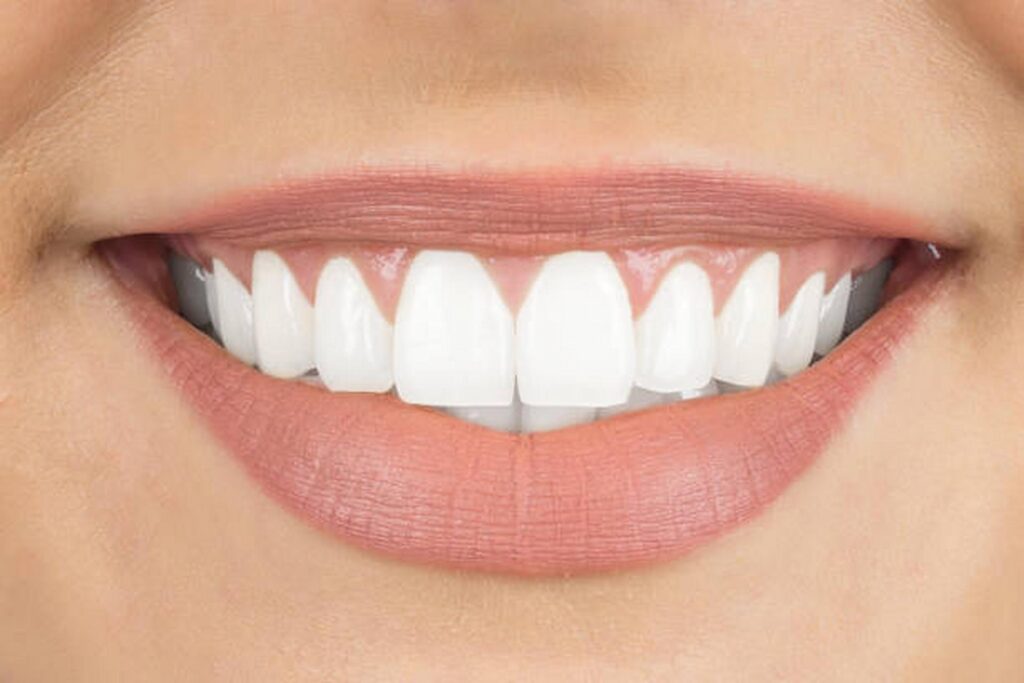 Affordable Methods To Enhance Your Smile